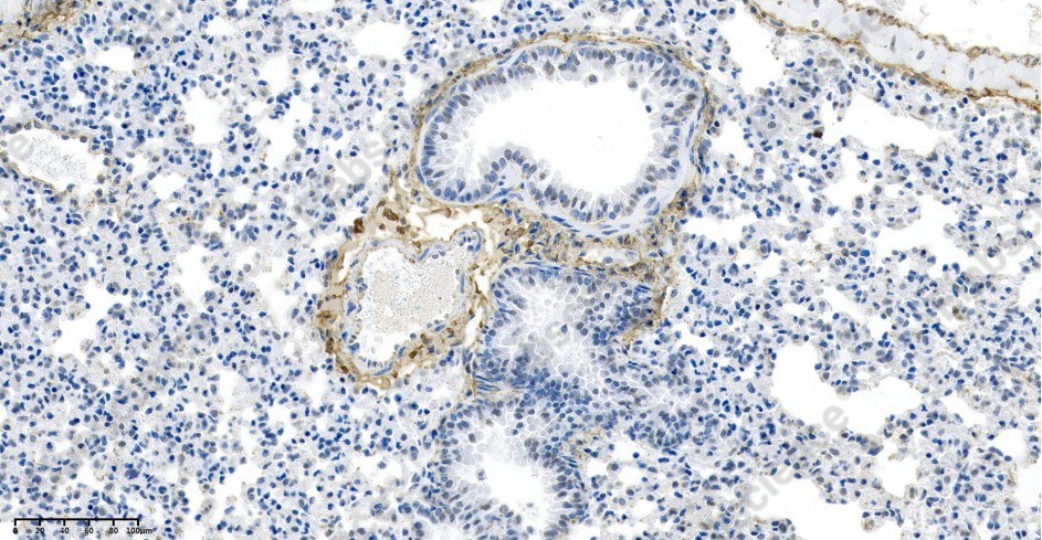 Recombinant VWF Monoclonal Antibody - 2