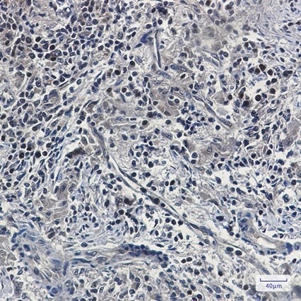 Recombinant UFM1 Monoclonal Antibody - 3