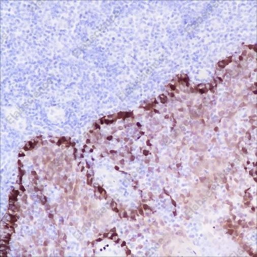 Recombinant ALDH3A1 Monoclonal Antibody - 4