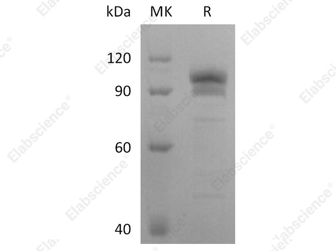 Recombinant Human EphB2 Protein (Fc Tag) - 1