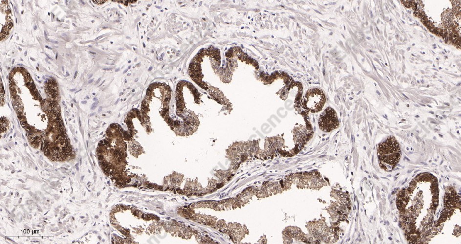 Recombinant Hsp70 Monoclonal Antibody - 2