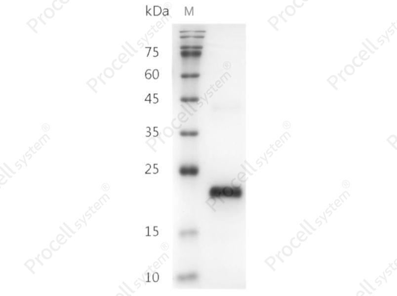VEGF165/VEGF-A, Human, Recombinant