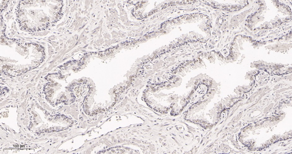 Recombinant METTL3 Monoclonal Antibody - small - 3