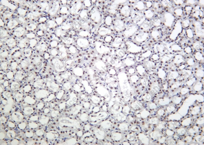 Recombinant Phospho-Smad3 (Ser423, Ser425) Monoclonal Antibody - 2