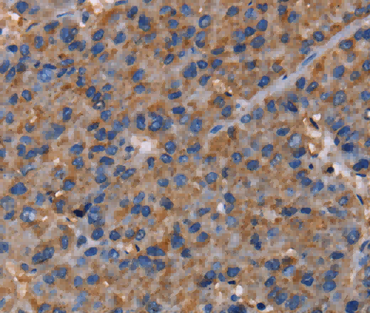 NUP62 Polyclonal Antibody - 2