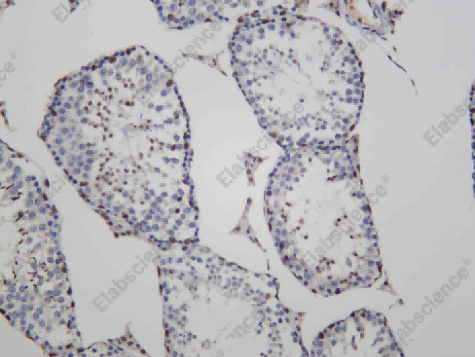 Recombinant MBD2 Monoclonal Antibody - 2