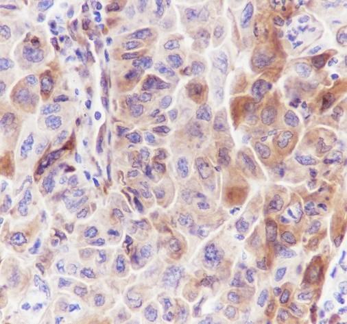 Recombinant STING Monoclonal Antibody - small - 4