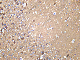 Recombinant Synaptotagmin 1 Monoclonal Antibody - 3