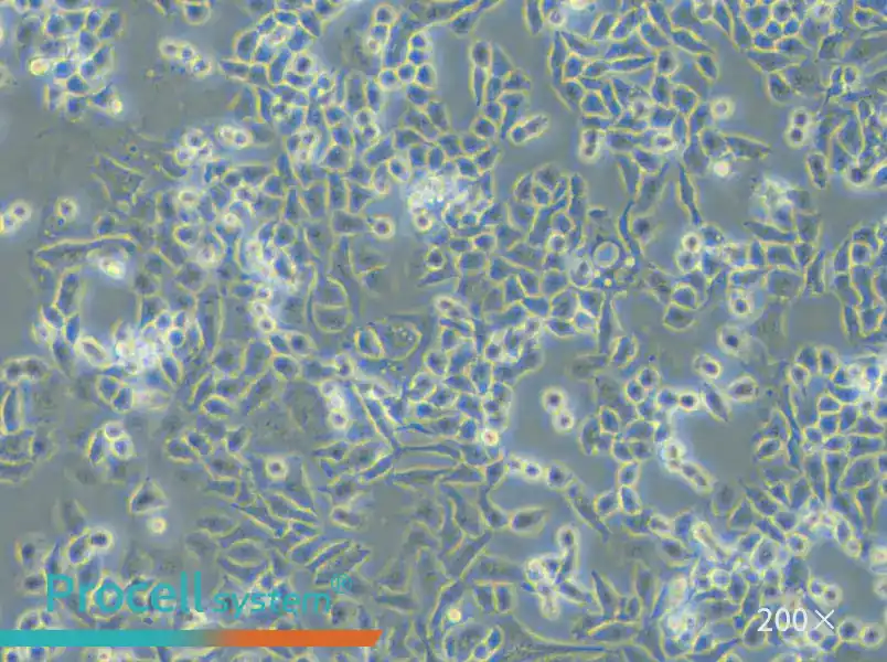 TOV-21G Cell Complete Medium - small - 6