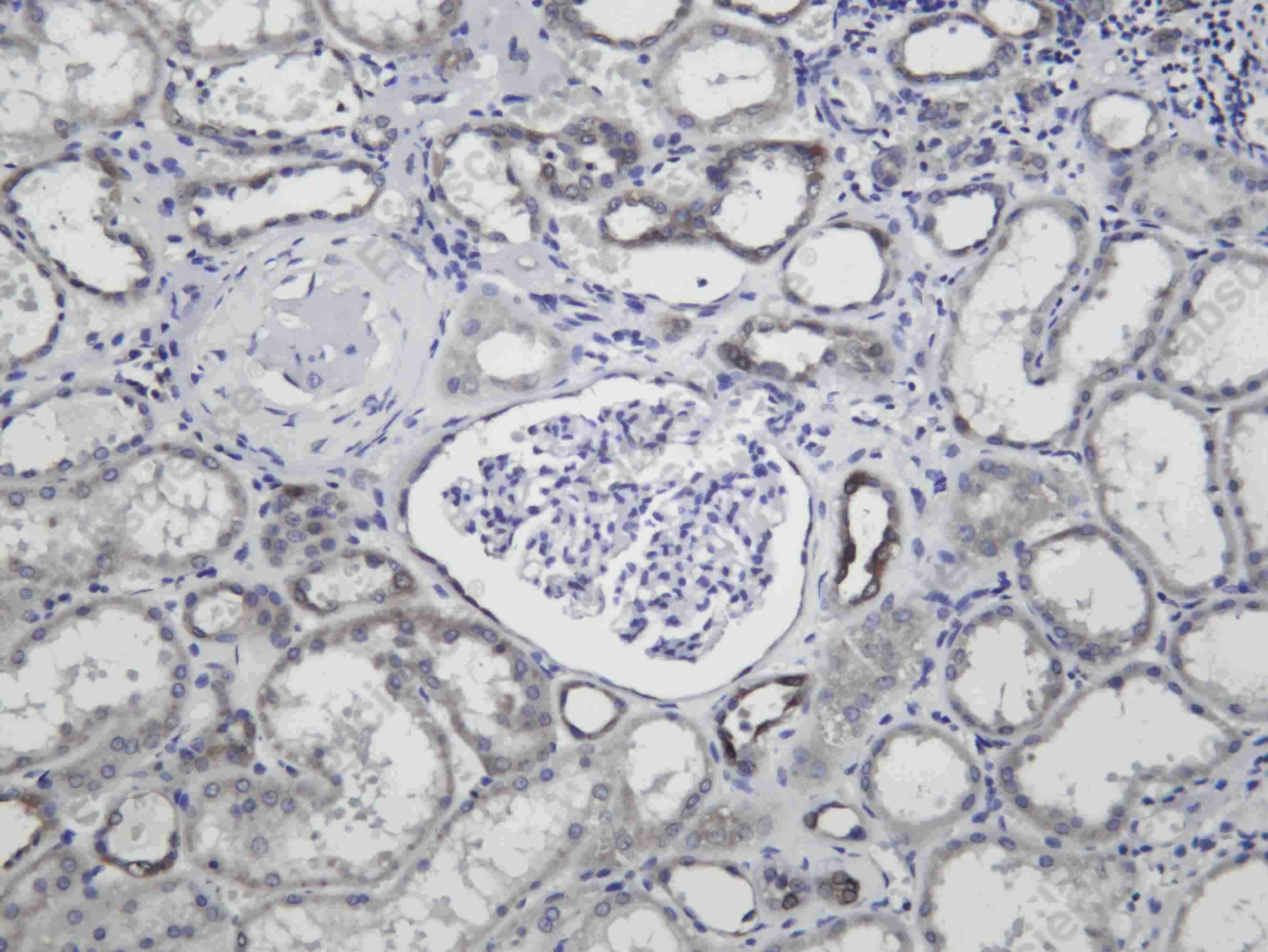 Recombinant FDFT Monoclonal Antibody - 1