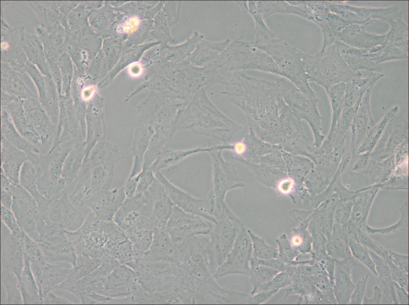 NCI-H196 Cell Complete Medium - small - 6