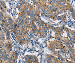 CHMP1A Polyclonal Antibody - 2