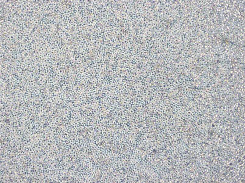 NOMO-1 Cell Complete Medium-searchlist-1