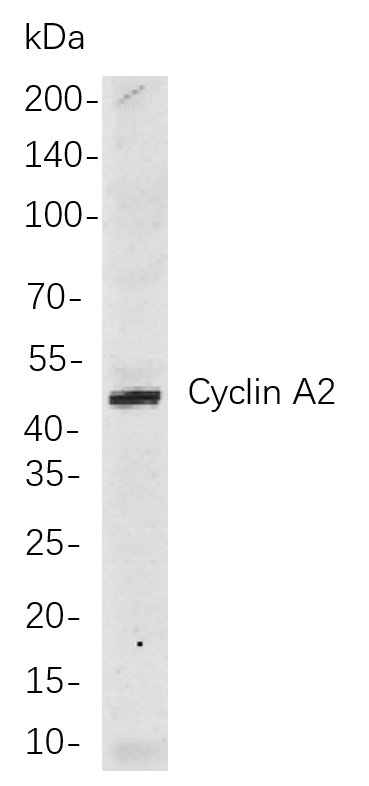 Recombinant Cyclin A2 Monoclonal Antibody-searchlist-1