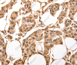 ACO2 Polyclonal Antibody - 2