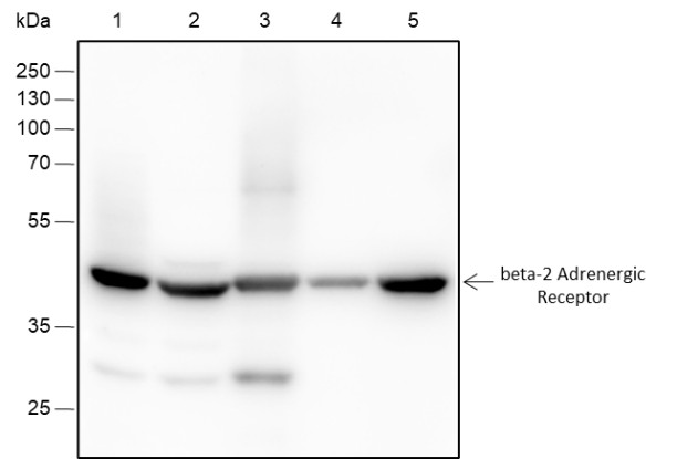 Recombinant beta-2 Adrenergic Receptor Monoclonal Antibody-searchlist-1