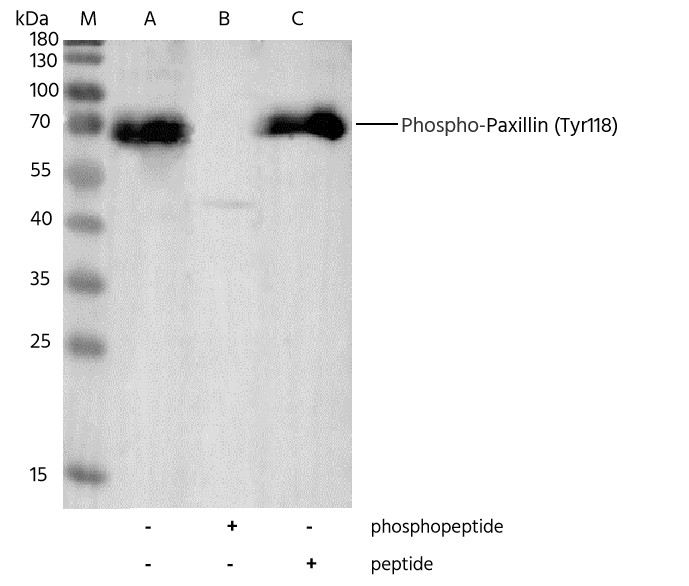 Recombinant Phospho-Paxillin (Tyr118) Monoclonal Antibody-searchlist-1