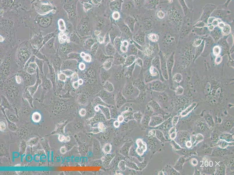 Anglne Cell Complete Medium - small - 5