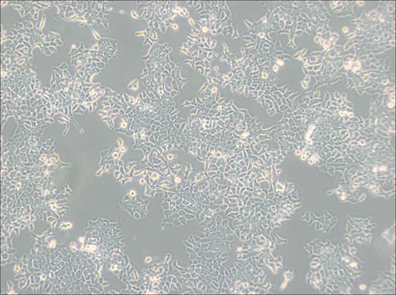 H-4-II-E [H4-II-E] Cell Complete Medium - 2