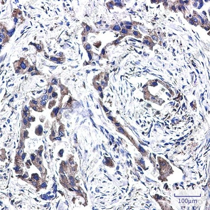 Recombinant FADS1 Monoclonal Antibody - 4
