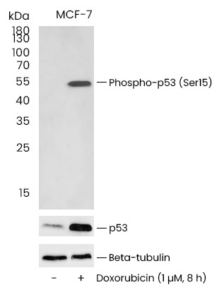 Recombinant Phospho-p53 (Ser15) Monoclonal Antibody - small - 2