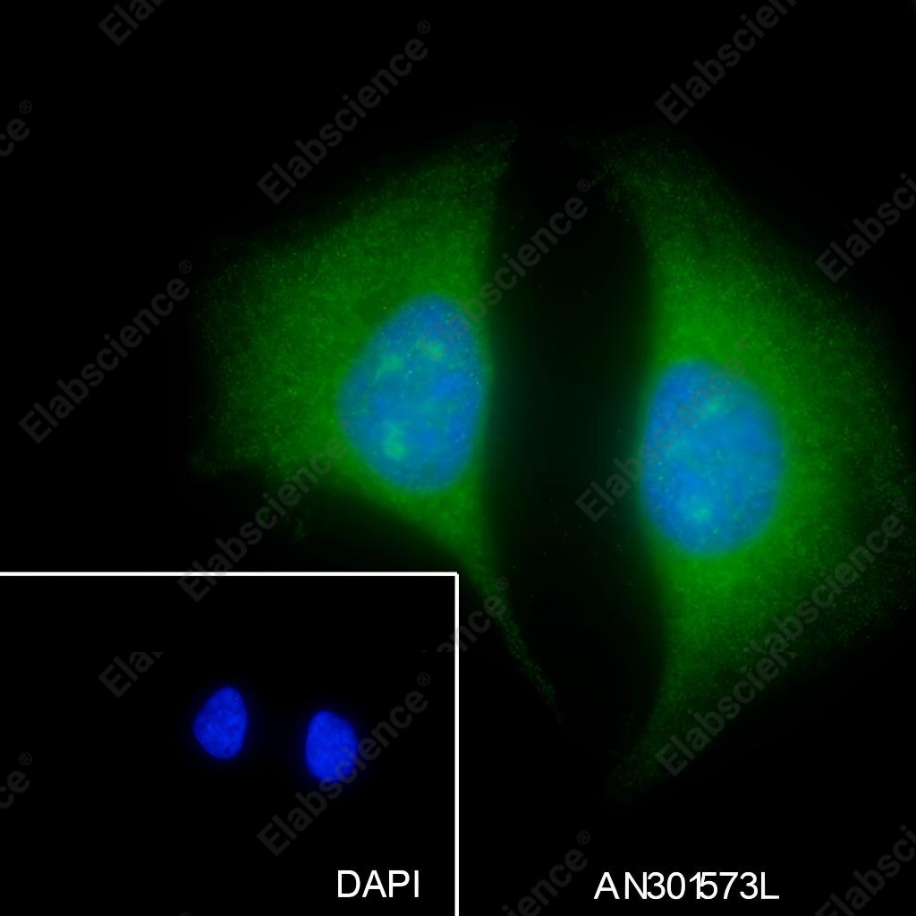 Recombinant ELP3 Monoclonal Antibody - 4