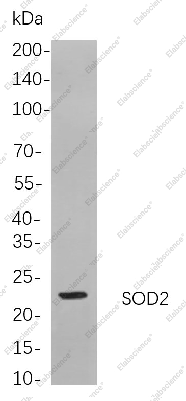 Recombinant SOD2 Monoclonal Antibody - 1
