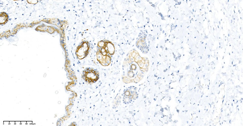 Recombinant Claudin 1 Monoclonal Antibody - small - 2