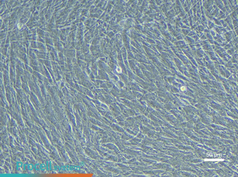 Rabbit Pulmonary Great Artery Smooth Muscle Cell Complete Medium - 5