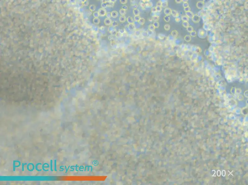 P3HR-1 Cell Complete Medium - small - 5