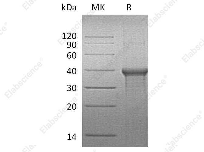 Recombinant Human BLVRA Protein (His Tag) - 1