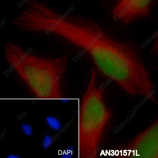 Recombinant JunB Monoclonal Antibody - 3