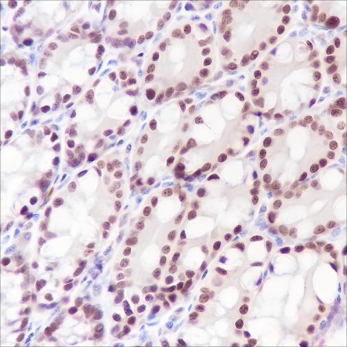 Recombinant Ku80 Monoclonal Antibody-searchlist-1