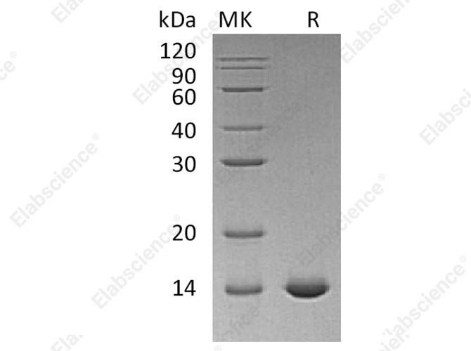 Recombinant Human Interleukin-2/IL-2 Protein (C145S) - 1