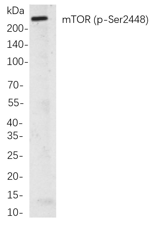 Recombinant Phospho-mTOR (Ser2448) Monoclonal Antibody-searchlist-1