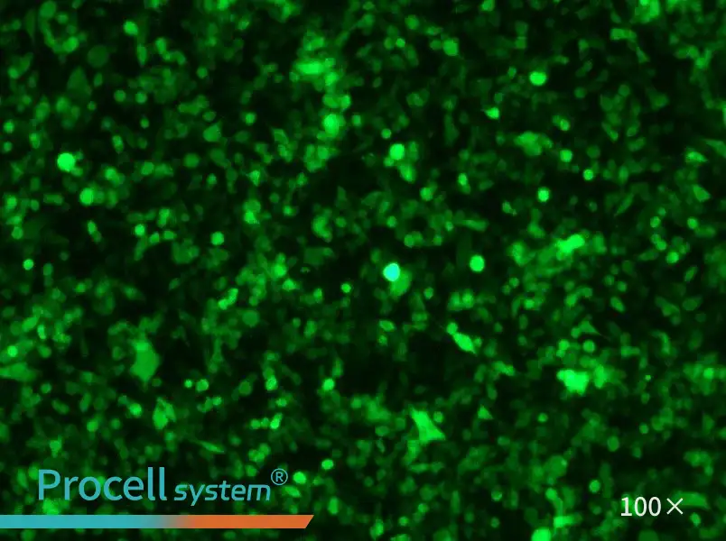 RM-1-GFP Cell Complete MediumRM-1-GFP Cell Complete Medium - 2