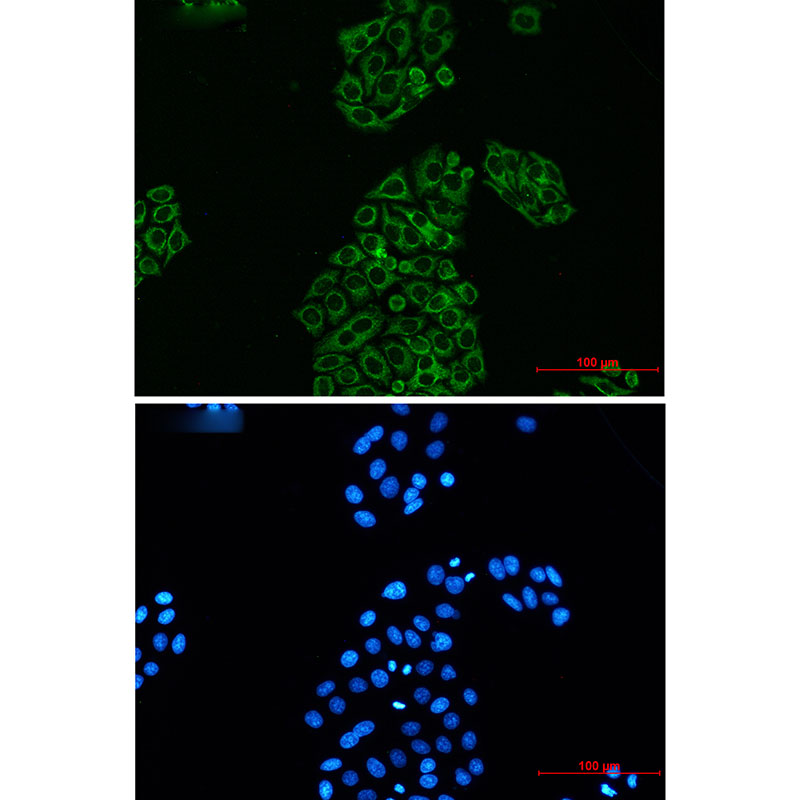 Recombinant AK2/Adenylate kinase 2 Monoclonal Antibody - small - 4