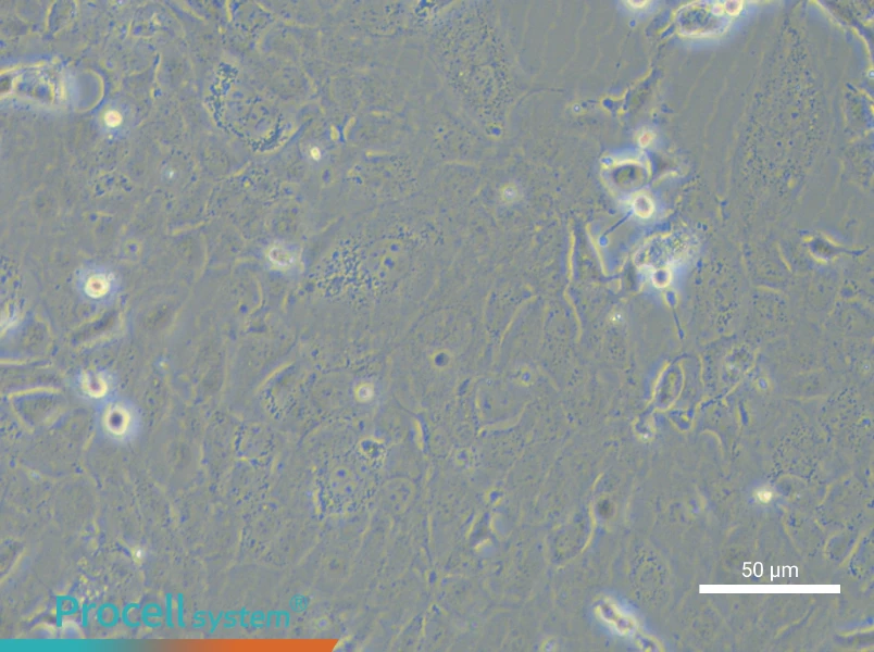 NCI-H1838 - 5