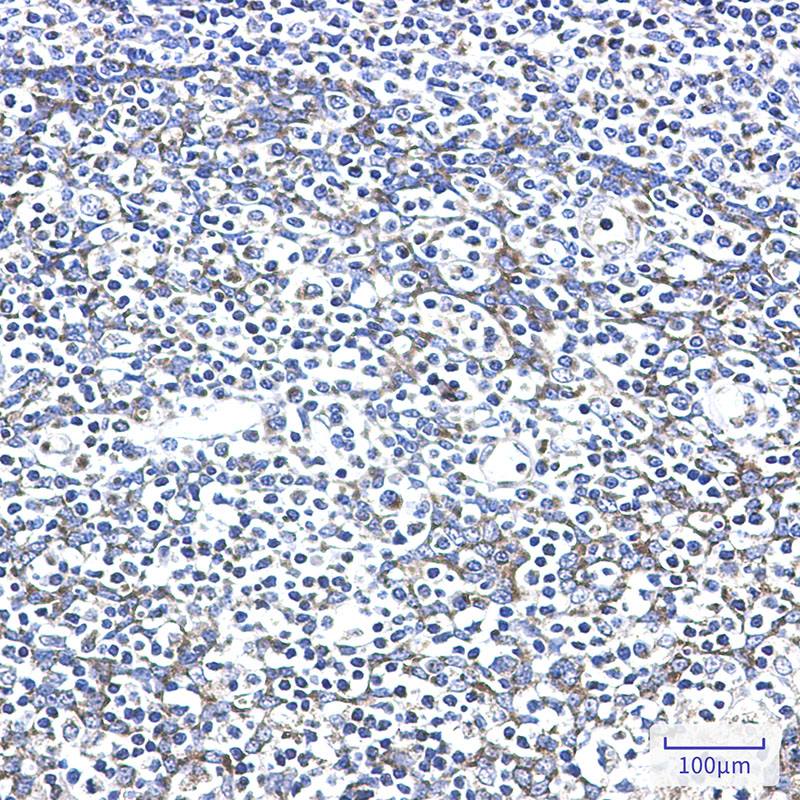 Recombinant AK2/Adenylate kinase 2 Monoclonal Antibody - 3