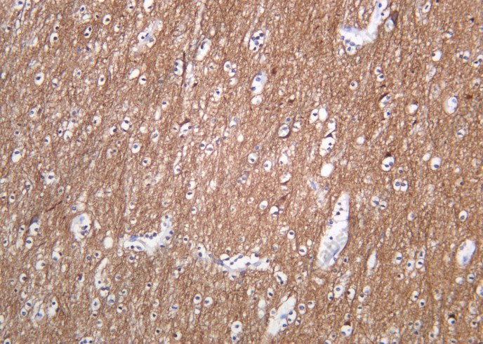 Recombinant Tubulin α (Acetyl Lys40) Monoclonal Antibody - 2