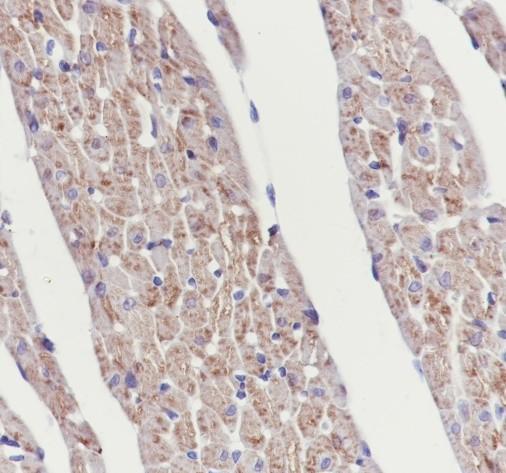 Recombinant SLC25A12 Monoclonal Antibody - 3