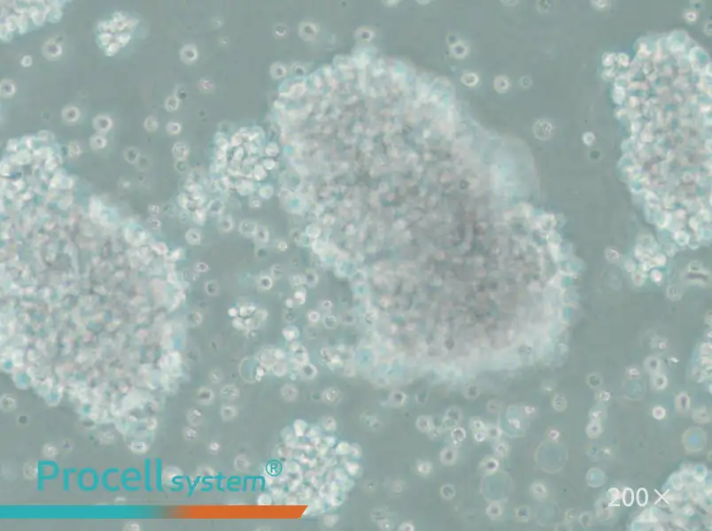 SU-DHL-10 Cell Complete Medium - 6