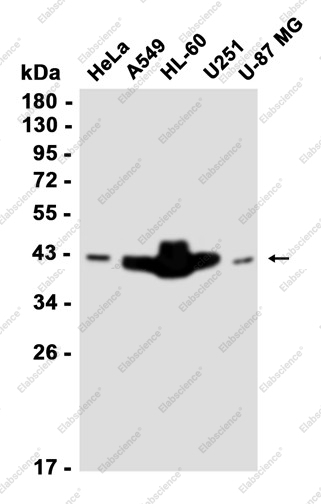 Recombinant Ataxin-3 Monoclonal Antibody - 1