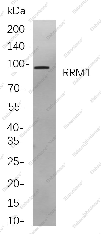 Recombinant RRM1 Monoclonal Antibody - 1