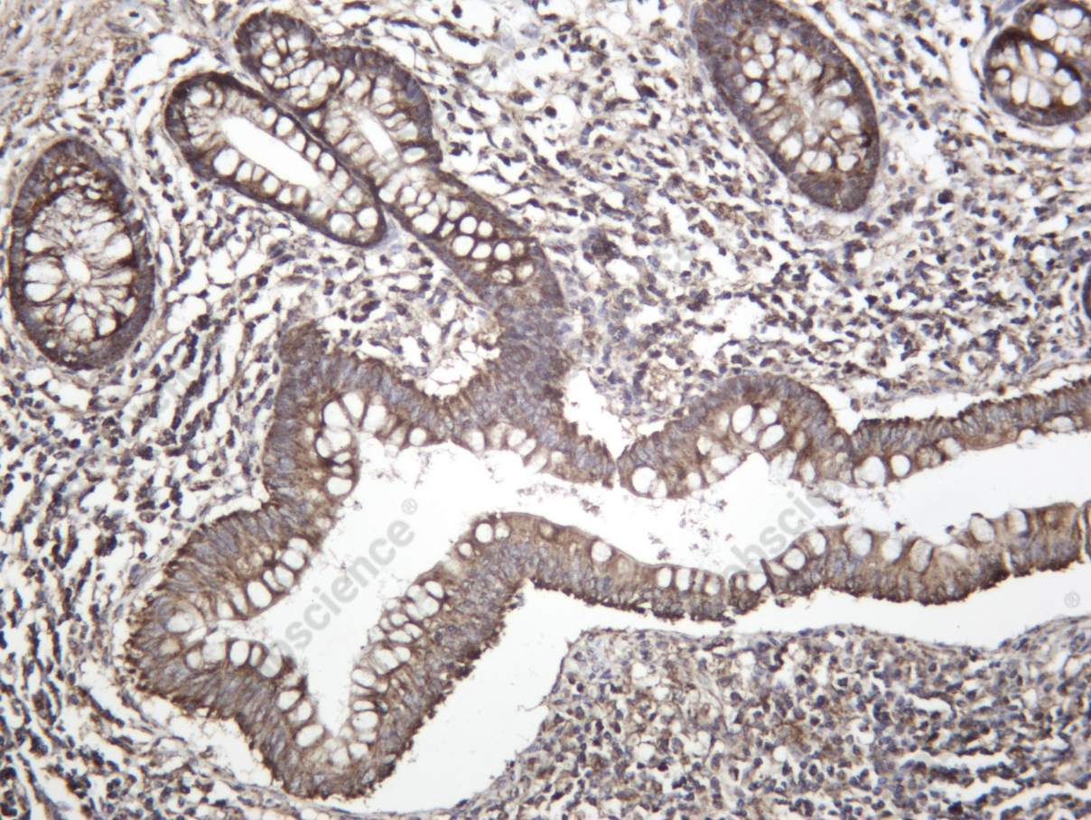 Recombinant LONP1 Monoclonal Antibody - 1