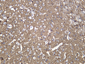 Recombinant Neurofascin Monoclonal Antibody - 3