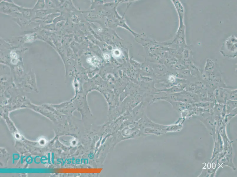 HLE-B3 Cell Complete Medium - 5