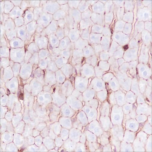 Recombinant Phospho-Girdin (Tyr1765) Monoclonal Antibody - small - 3