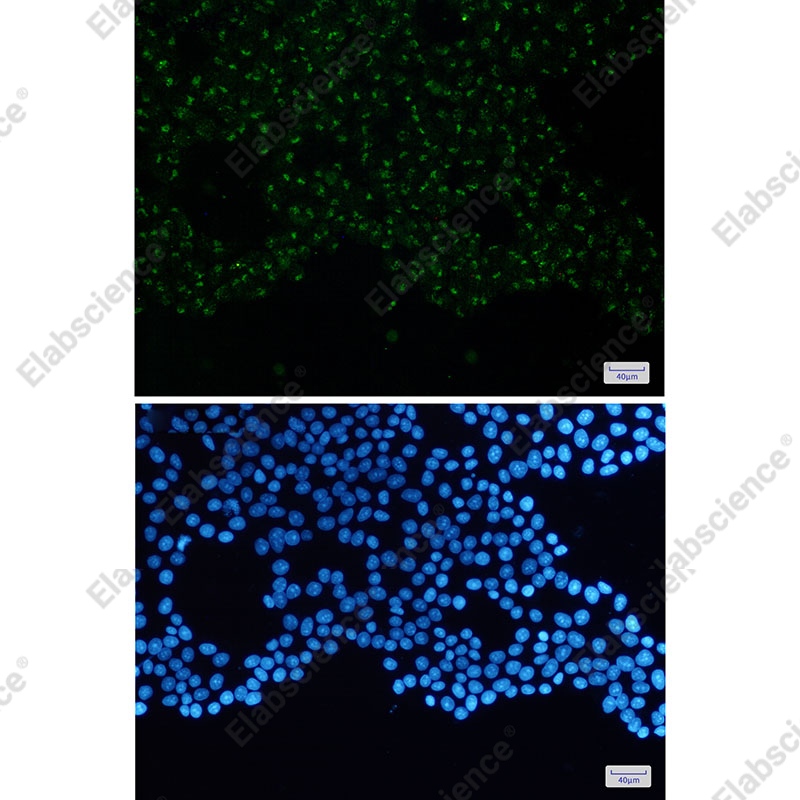 Recombinant N WASP Monoclonal Antibody - 2