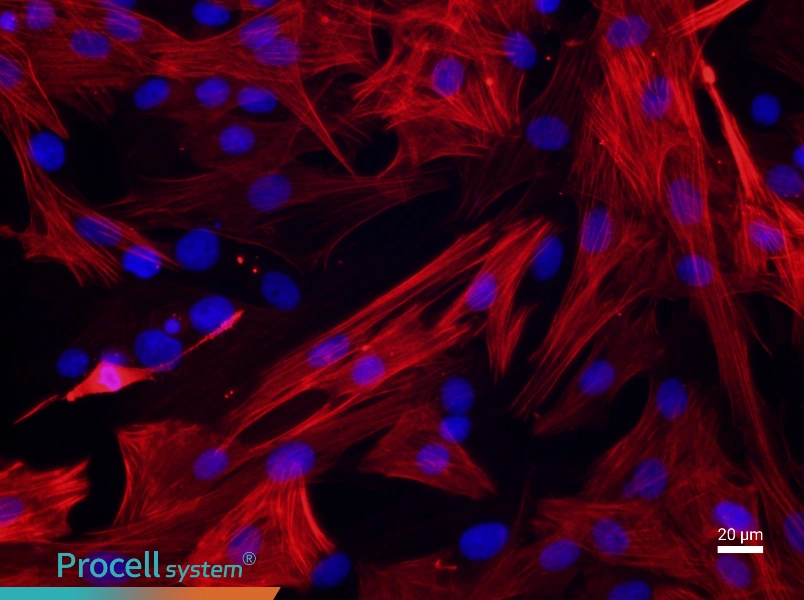 Rat Pulmonary Great Artery Smooth Muscle CellsRat Pulmonary Great Artery Smooth Muscle Cells - 2